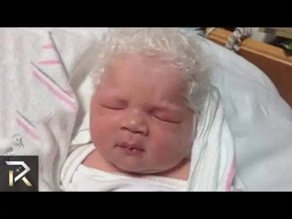 Video: Unusual Babies You